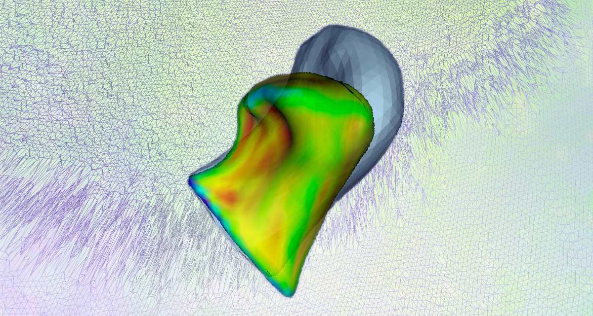 Regímenes del volumen